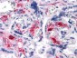 MAP2K2 Antibody
